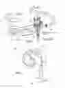 Fig. 03 - Cochlear implant system