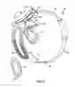 Fig. 09 - Visual prosthesis including an improved video processing unit