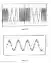 Fig. 08 - Method and apparatus for multimodal electrical modulation of pain