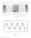 Fig. 08 - Method and apparatus for multimodal electrical modulation of pain