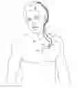 Fig. 01 - Devices and methods for sensing physiological signals during stimulation therapy