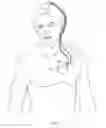 Fig. 02 - Devices and methods for sensing physiological signals during stimulation therapy