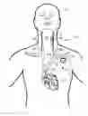 Fig. 01 - Dynamic stimulation adjustment for identification of a neural fulcrum