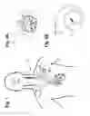 Fig. 02 - Dynamic stimulation adjustment for identification of a neural fulcrum