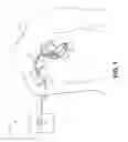 Fig. 02 - Power management for an implantable device