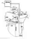 Fig. 01 - Method and device for three-stage atrial cardioversion therapy