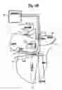 Fig. 03 - Method and device for three-stage atrial cardioversion therapy