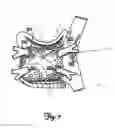 Fig. 10 - Method and device for three-stage atrial cardioversion therapy