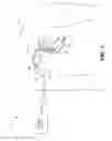 Fig. 02 - Mitigating implantable device power drain associated with stalled telemetry sessions