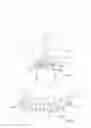 Fig. 03 - Tooth-whitening device