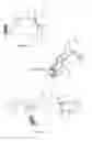 Fig. 02 - METHOD AND APPARATUS FOR AN EMERGENCY AIR BREATHING SYSTEM