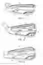 Fig. 08 - Supported iron set