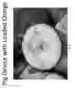 Fig. 09 - Device for Thermal Ablation of Pigging Devices