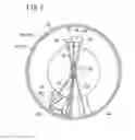 Fig. 04 - PLATELET SEPARATOR AND PLATELET RECOVERY DEVICE