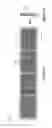 Fig. 100 - Injection molded screening apparatuses and methods