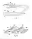 Fig. 106 - Injection molded screening apparatuses and methods