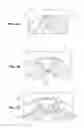 Fig. 04 - Piston of an internal combustion engine having alkali metal cooling and method for production thereof