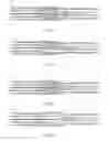 Fig. 04 - Method and system for dynamically following laser cutting with magnetic belt