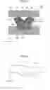 Fig. 05 - Method of producing an outer blade for a hair cutting device