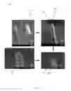 Fig. 41 - Nanostructures from Laser-Ablated Nanohole Templates