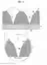 Fig. 08 - MANUFACTURING METHOD OF SHEET HAVING NEEDLE-LIKE PROTRUSIONS