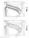 Fig. 04 - Two-shot molding for selectively metalizing parts