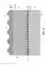Fig. 11 - TRACK SYSTEM FOR TRACTION OF A VEHICLE