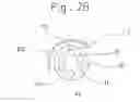Fig. 04 - Medicine conveying apparatus