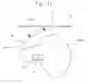 Fig. 15 - Medicine conveying apparatus