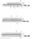 Fig. 03 - Planar cavity MEMS and related structures, methods of manufacture and design structures