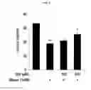 Fig. 08 - NOVEL ISONITRAMINE COMPOUND AND COMPOSITION CONTAINING SAME FOR PREVENTING OR TREATING METABOLIC DISEASES