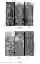 Fig. 05 - Herbicide-resistant protein, encoding gene and use thereof