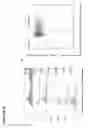 Fig. 03 - Modified monocytes/macrophage expressing chimeric antigen receptors and uses thereof