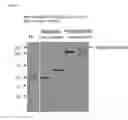 Fig. 09 - Tetra-specific, octameric binding agents and antibodies against toxin A and toxin B for treatment of  infection