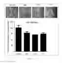 Fig. 11 - Antibody to human and mouse SEMA3A and use thereof