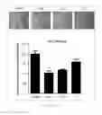 Fig. 22 - Antibody to human and mouse SEMA3A and use thereof