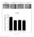 Fig. 23 - Antibody to human and mouse SEMA3A and use thereof