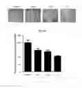 Fig. 24 - Antibody to human and mouse SEMA3A and use thereof