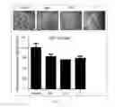 Fig. 11 - Antibody to human and mouse Sema3A and use thereof