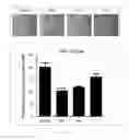 Fig. 22 - Antibody to human and mouse Sema3A and use thereof