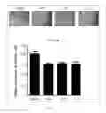 Fig. 23 - Antibody to human and mouse Sema3A and use thereof