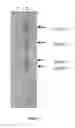 Fig. 03 - Humanized Antibodies to Cluster of Differentiation 3 (CD3)