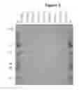 Fig. 04 - Humanized Antibodies to Cluster of Differentiation 3 (CD3)