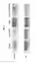 Fig. 03 - ANTI-FIBROTIC EFFECT OF CD70