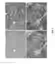 Fig. 09 - Antibodies and assays for detection of CD37