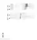 Fig. 03 - Monoclonal antibodies against antithrombin beta