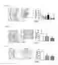 Fig. 11 - METHODS FOR INHIBITING ATHEROSCLEROSIS BY ADMINISTERING AN INHIBITOR OF PCSK9