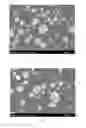 Fig. 02 - Spherical supported transition metal catalyst