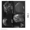 Fig. 02 - Microabrasive compositions containing oöids