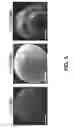 Fig. 07 - Microabrasive compositions containing oöids